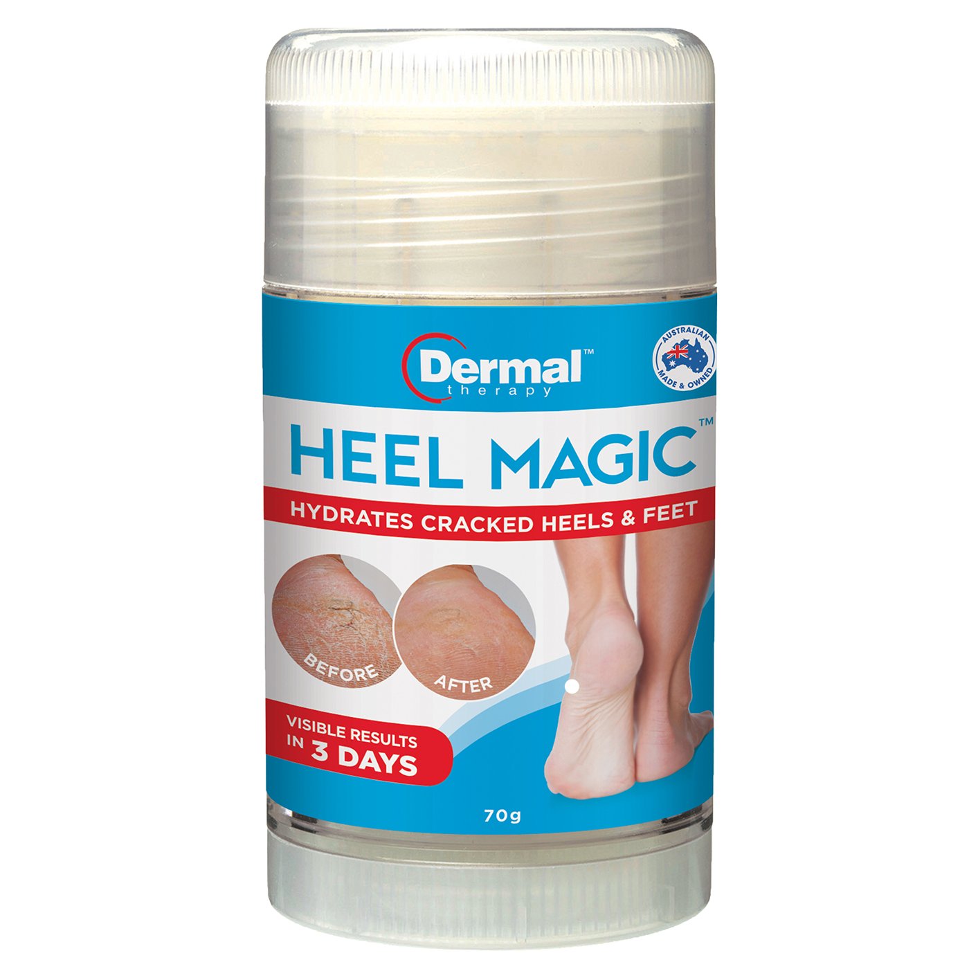 Dermal Therapy Roll On Heel Magic 70g|Before & After Shot Of Skin Following Dermal Therapy Heel Magic Treatment