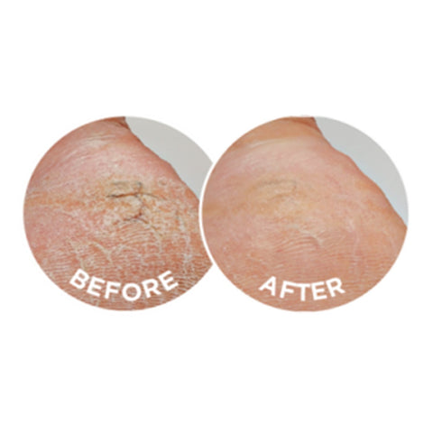 Dermal Therapy Roll On Heel Magic 70g